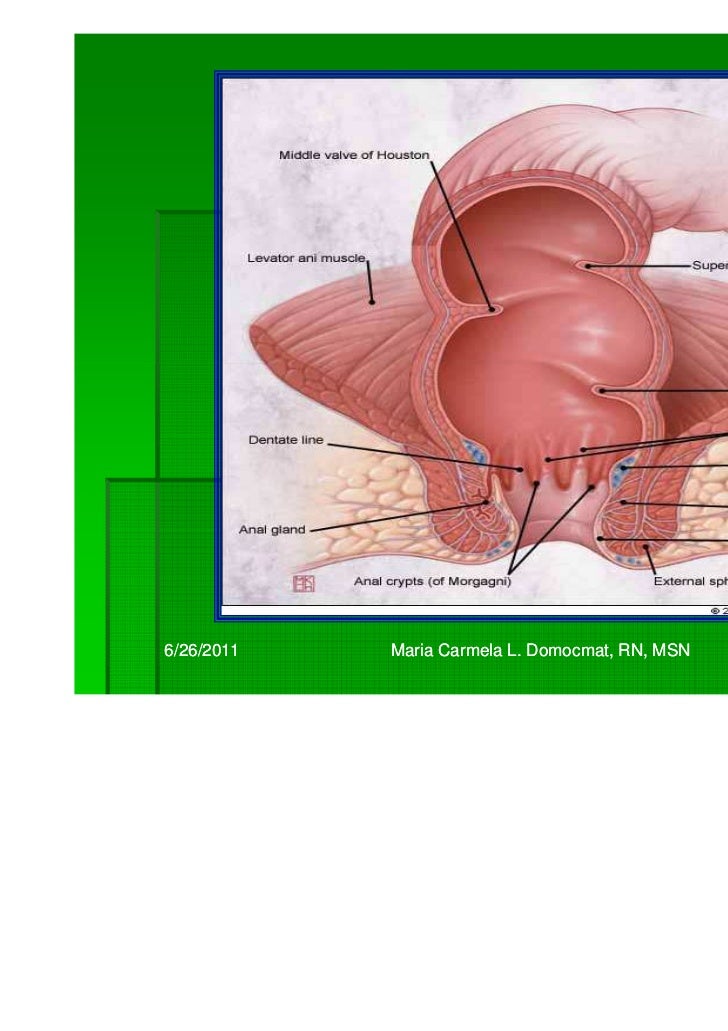 msn for anal fissure Msn for anal fissure